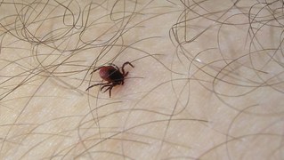 Jetzt über Zeckenschutzimpfung informieren